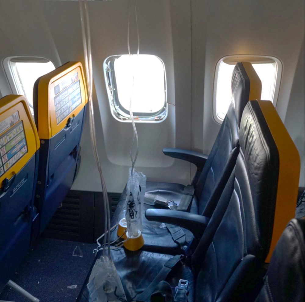 Ryanair CEO disputes report that an injured passenger was partly sucked out a shattered window