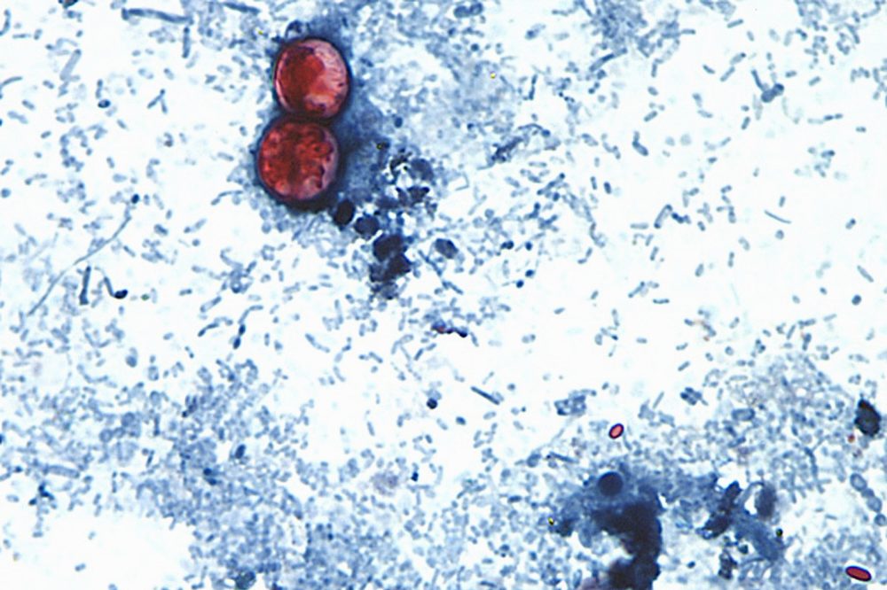US officials declare an end to record-setting cyclospora outbreak, but its origin is still unknown